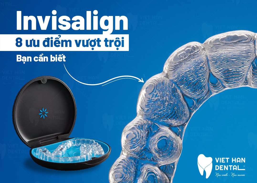 8 ưu điểm vượt trội mà niềng răng Invisalign mang lại
