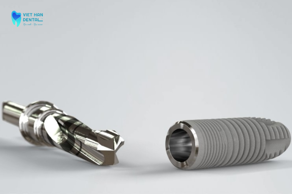 Trụ Implant Neodent được sản xuất tại Thụy Sĩ